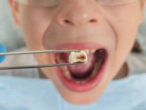 Best Holiday Emergency Dentist in Pomona Park, FL
